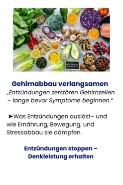 Consult Media Verlag Ratgeber|Lebensratgeber-Masterplan gegen Alzheimer. Fit im Kopf - ein Leben lang. Wie Sie frühzeitig Ihr Demenz-Risiko halbieren, Ihr Gehirn regenerieren und geistig fit bleiben. Spiegel-Bestsellerautor