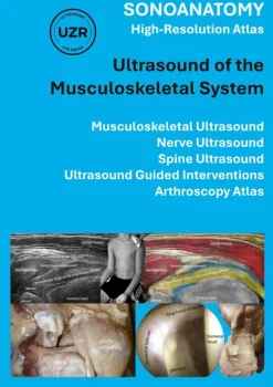 BoD - Books on Demand Sachbücher|Englische Bücher-Sonoanatomy - High-Resolution Atlas - Ultrasound of the Musculoskeletal System